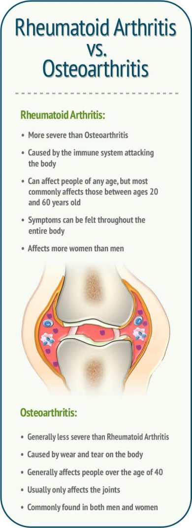 rheumatoid-arthritis-medicaltone
