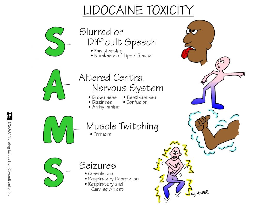 lidocaine toxicity